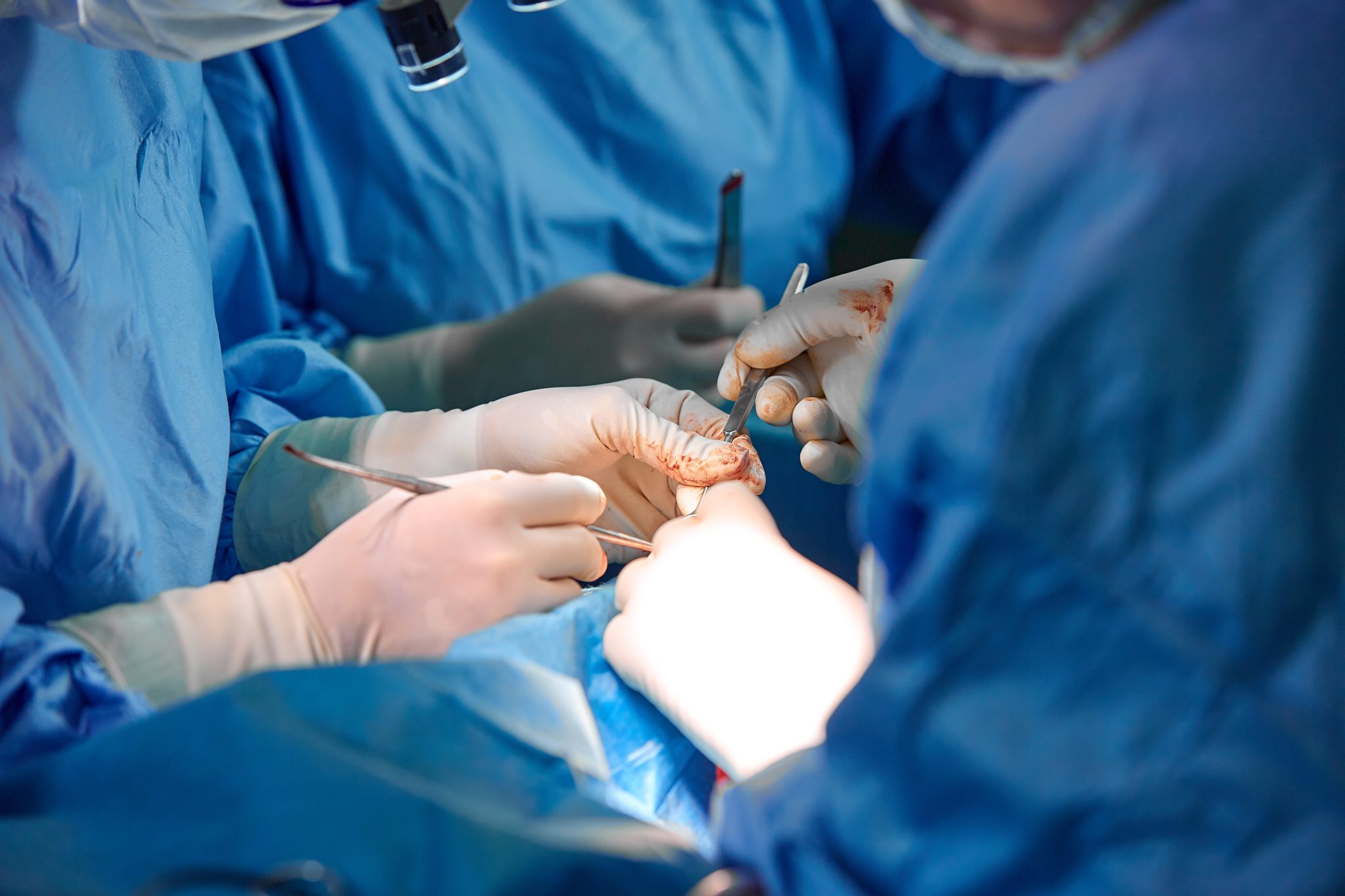 Skin Grafting | Innovation Medical Group